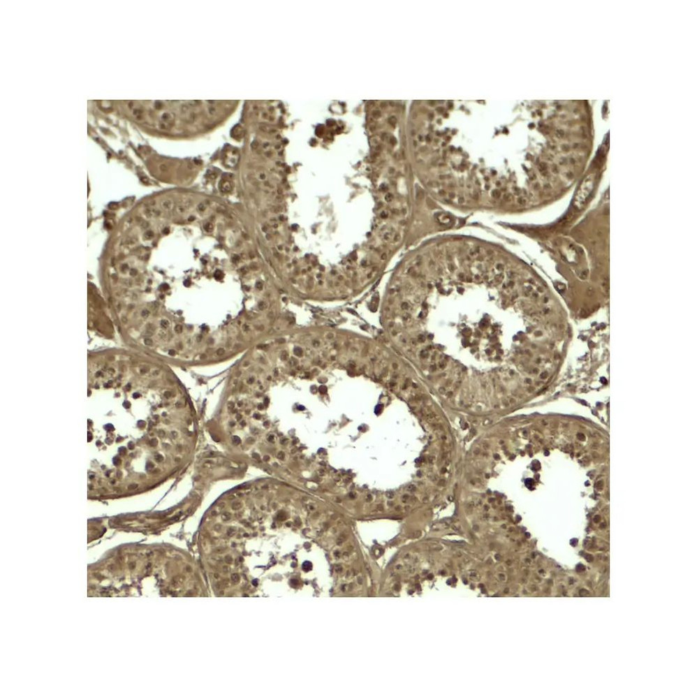 ProSci 8075 ATG4D Antibody