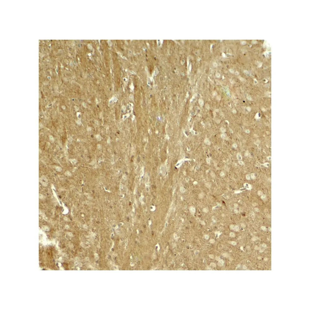 ProSci 8077 TAU Antibody