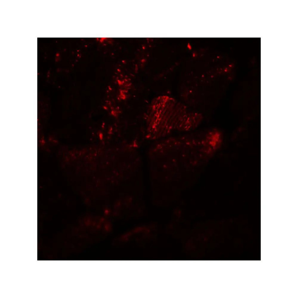 ProSci 8081 MYH8 Antibody