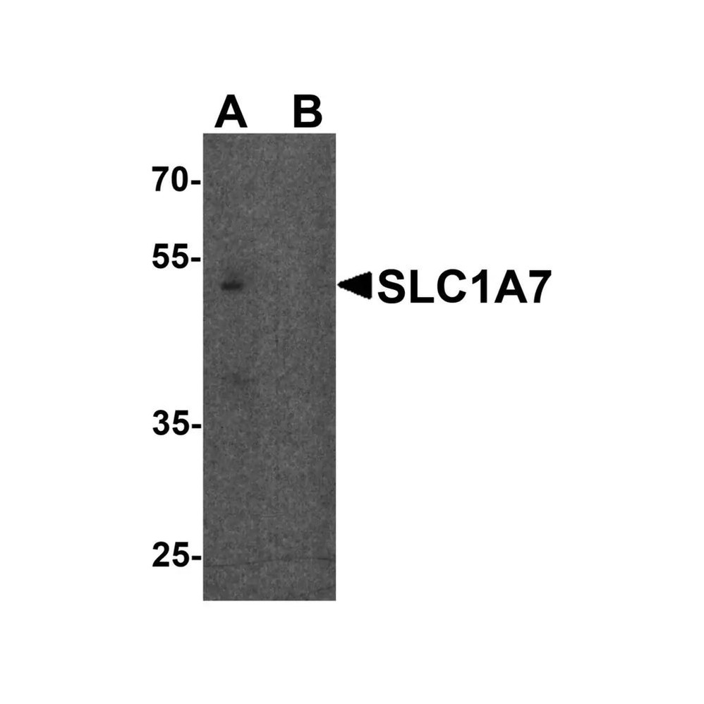 ProSci 8083 SLC1A7 Antibody