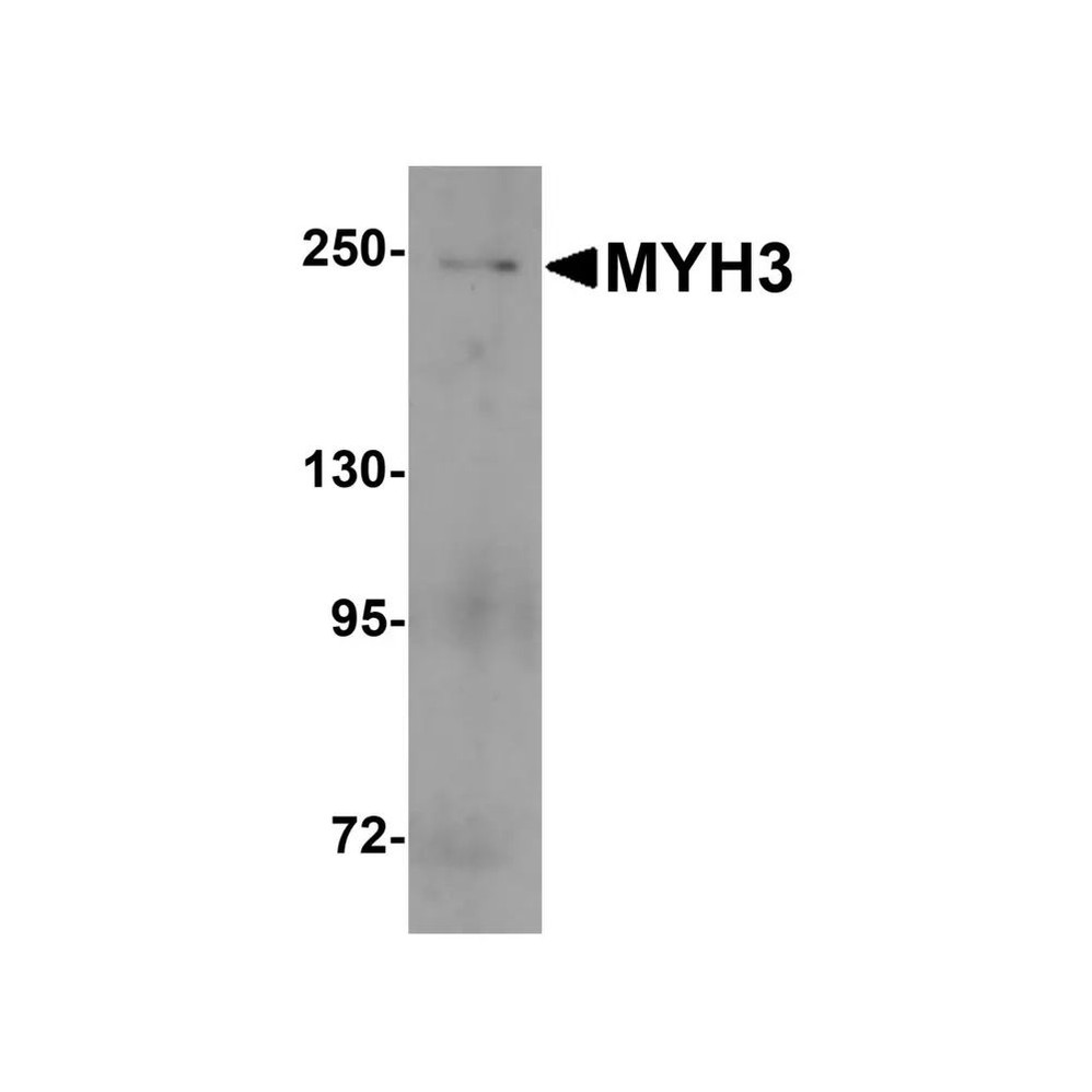 ProSci 8087 MYH3 Antibody