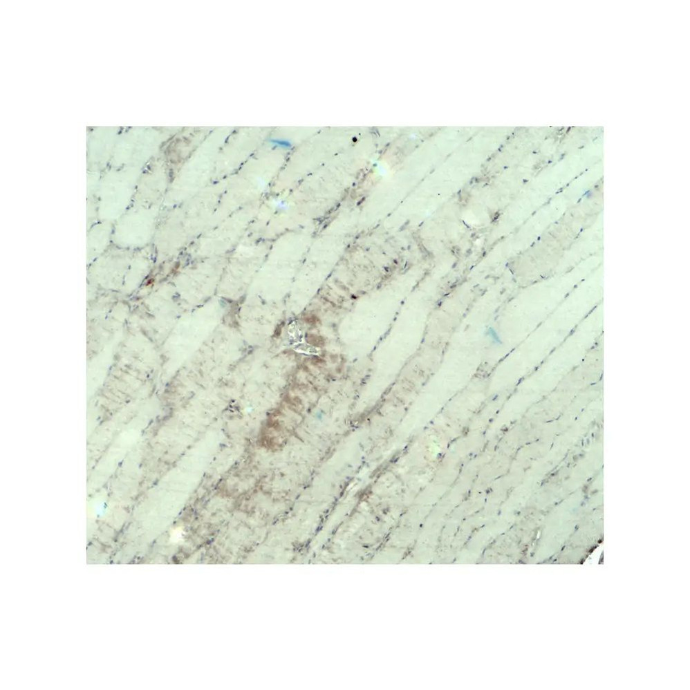 ProSci 8087 MYH3 Antibody