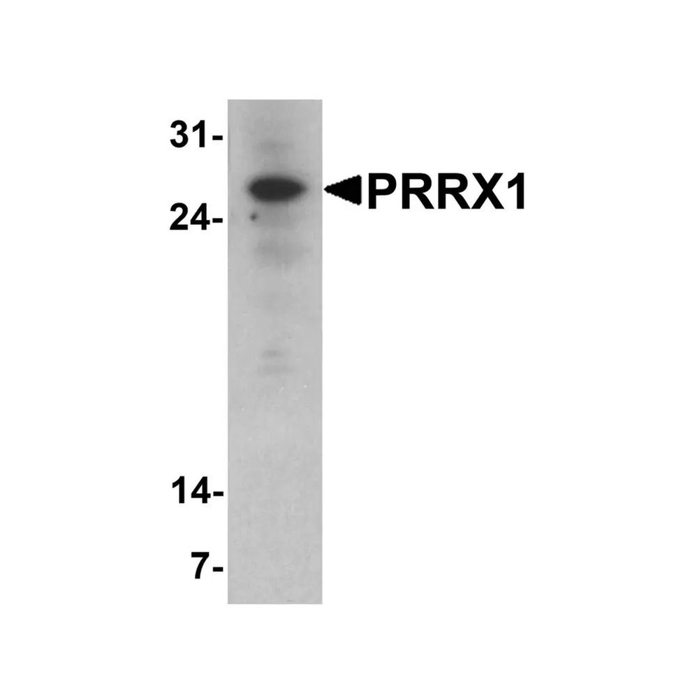 ProSci 8093 PRRX1 Antibody