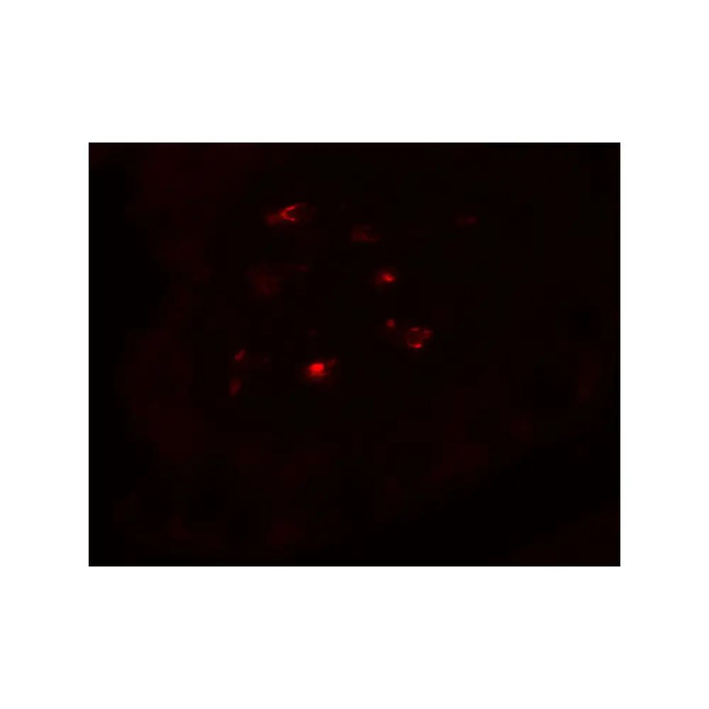 ProSci 8101 CTHRC1 Antibody