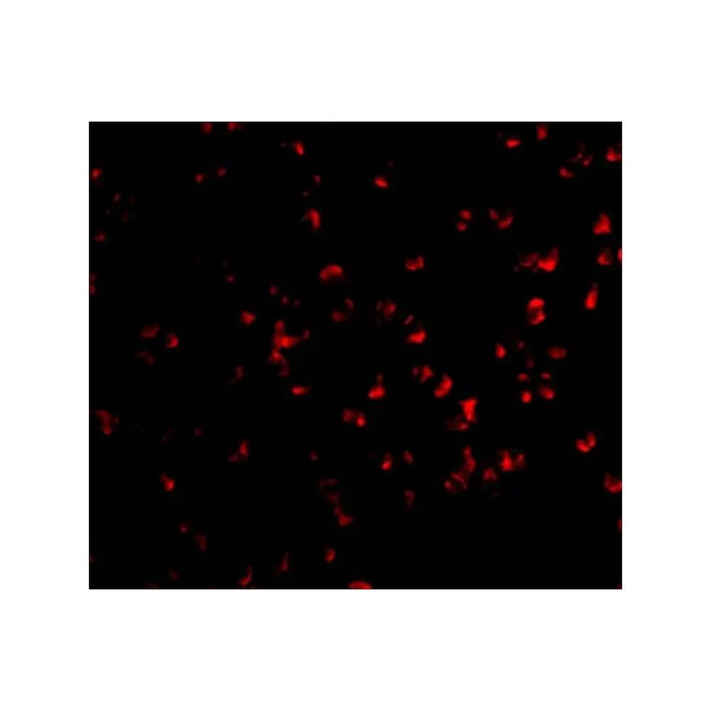 ProSci 2025 IKK alpha Antibody