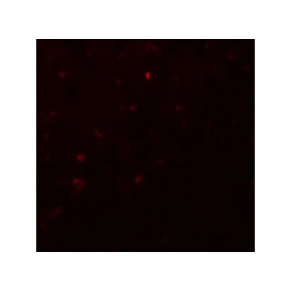 ProSci 8117 IKZF2 Antibody