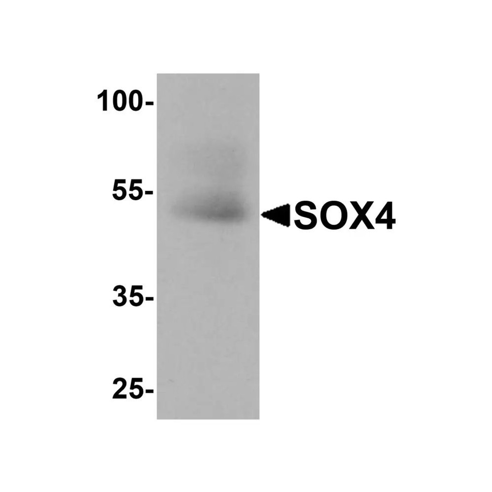 ProSci 8123 SOX4 Antibody