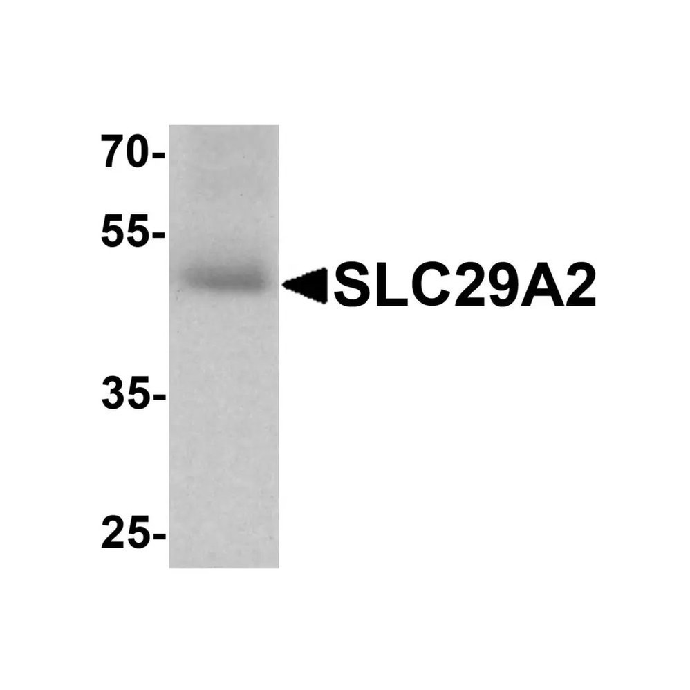 ProSci 8127 SLC29A2 Antibody