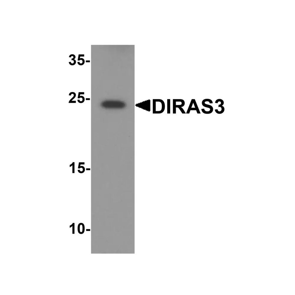 ProSci 8139 DIRAS3 Antibody