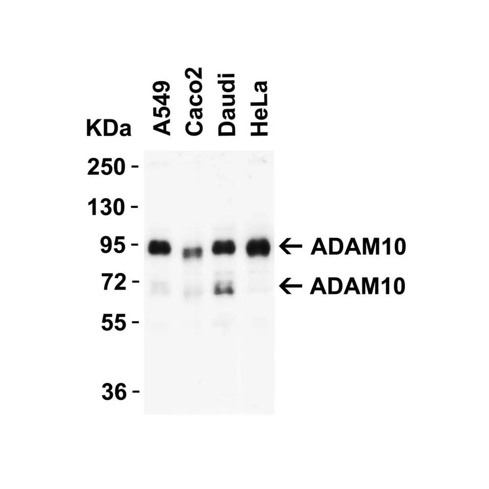 ProSci 2051 ADAM10 Antibody
