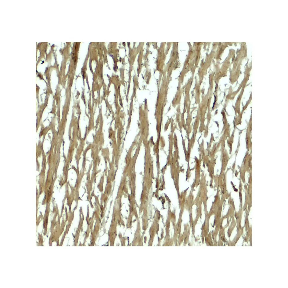 ProSci 8143 HOPX Antibody