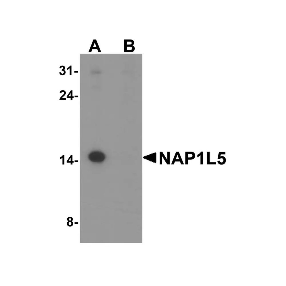 ProSci 8147 NAP1L5 Antibody