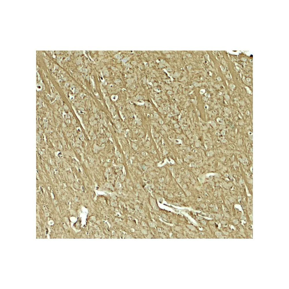ProSci 8149 TENM1 Antibody