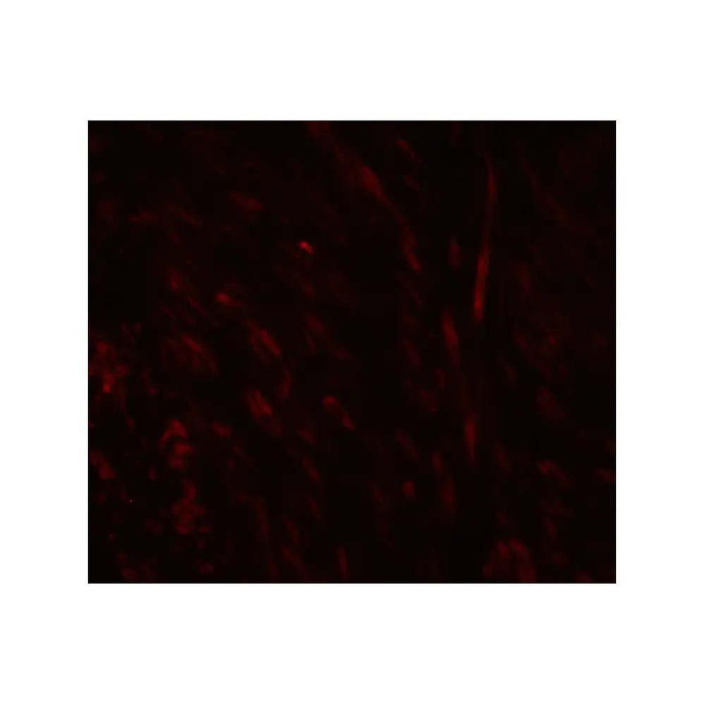 ProSci 8157 SPIB Antibody
