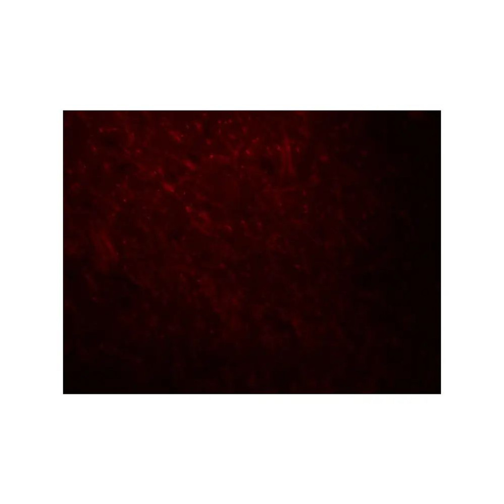 ProSci 8173 ARID1A Antibody