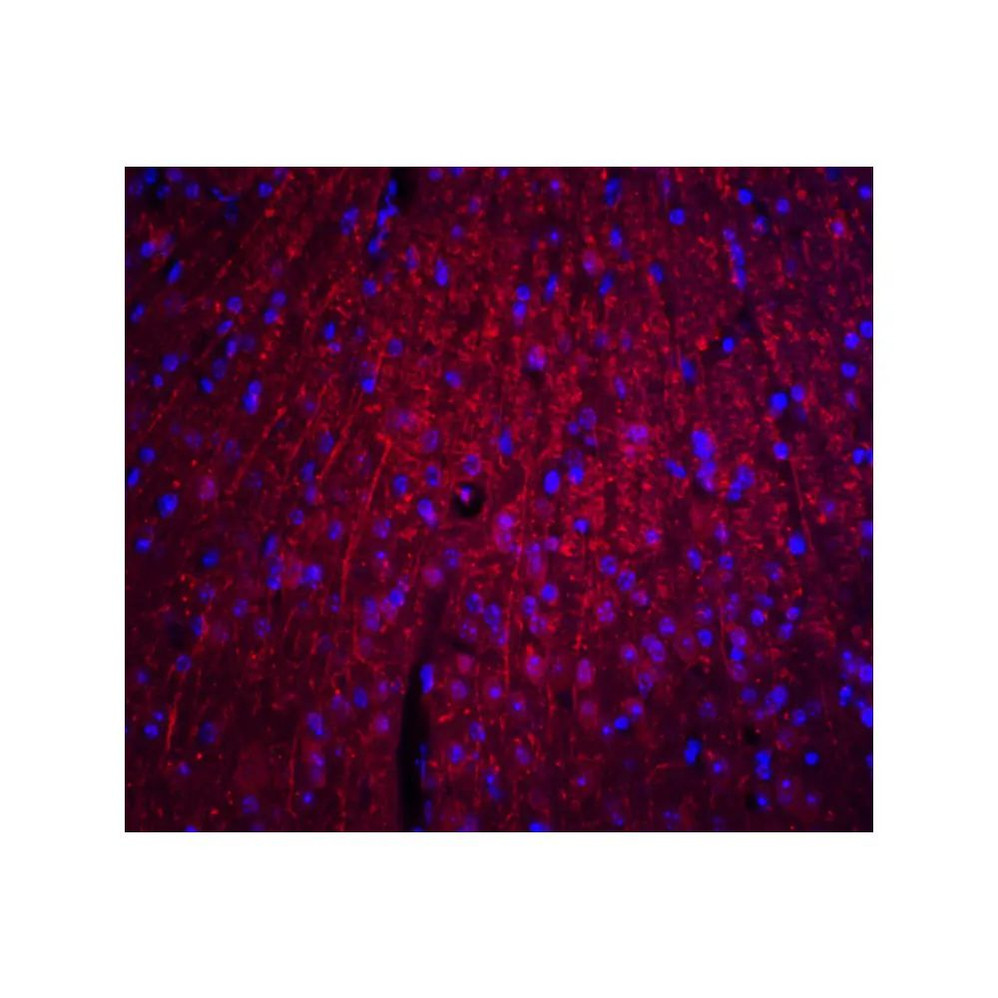 ProSci 8173 ARID1A Antibody