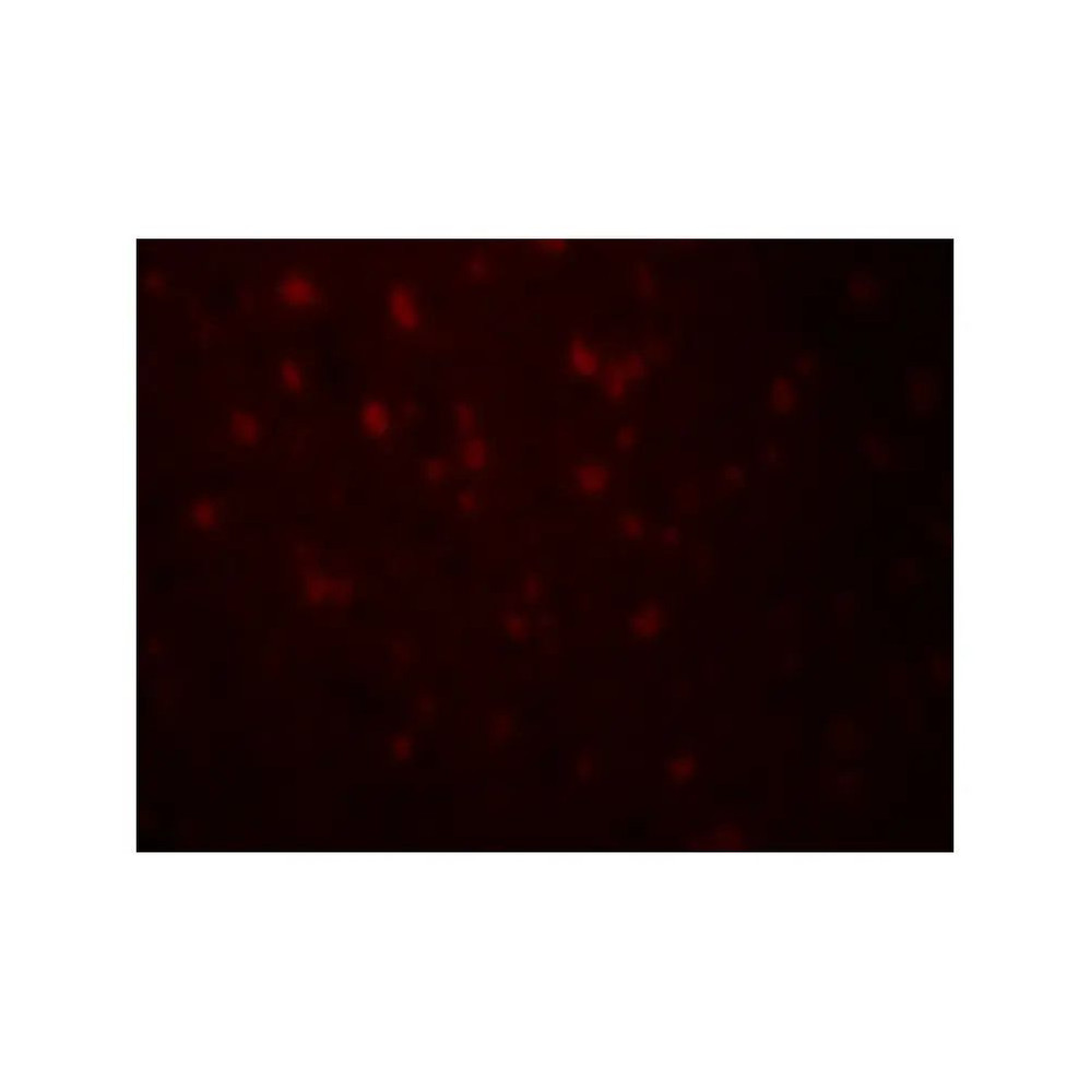 ProSci 8181 RLN3 Antibody