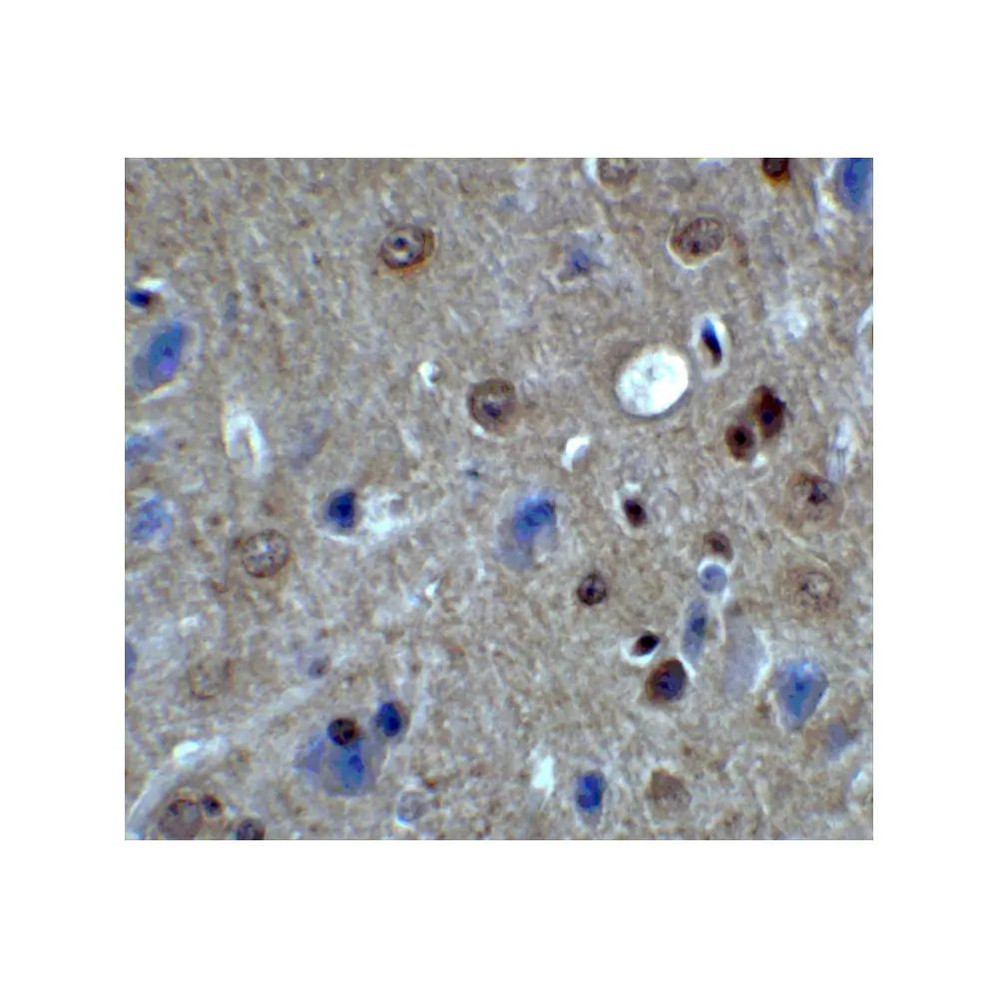 ProSci 8187 PACS1 Antibody