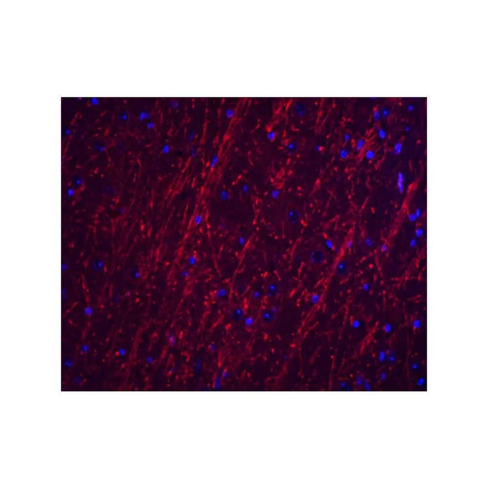 ProSci 8189 PACS2 Antibody