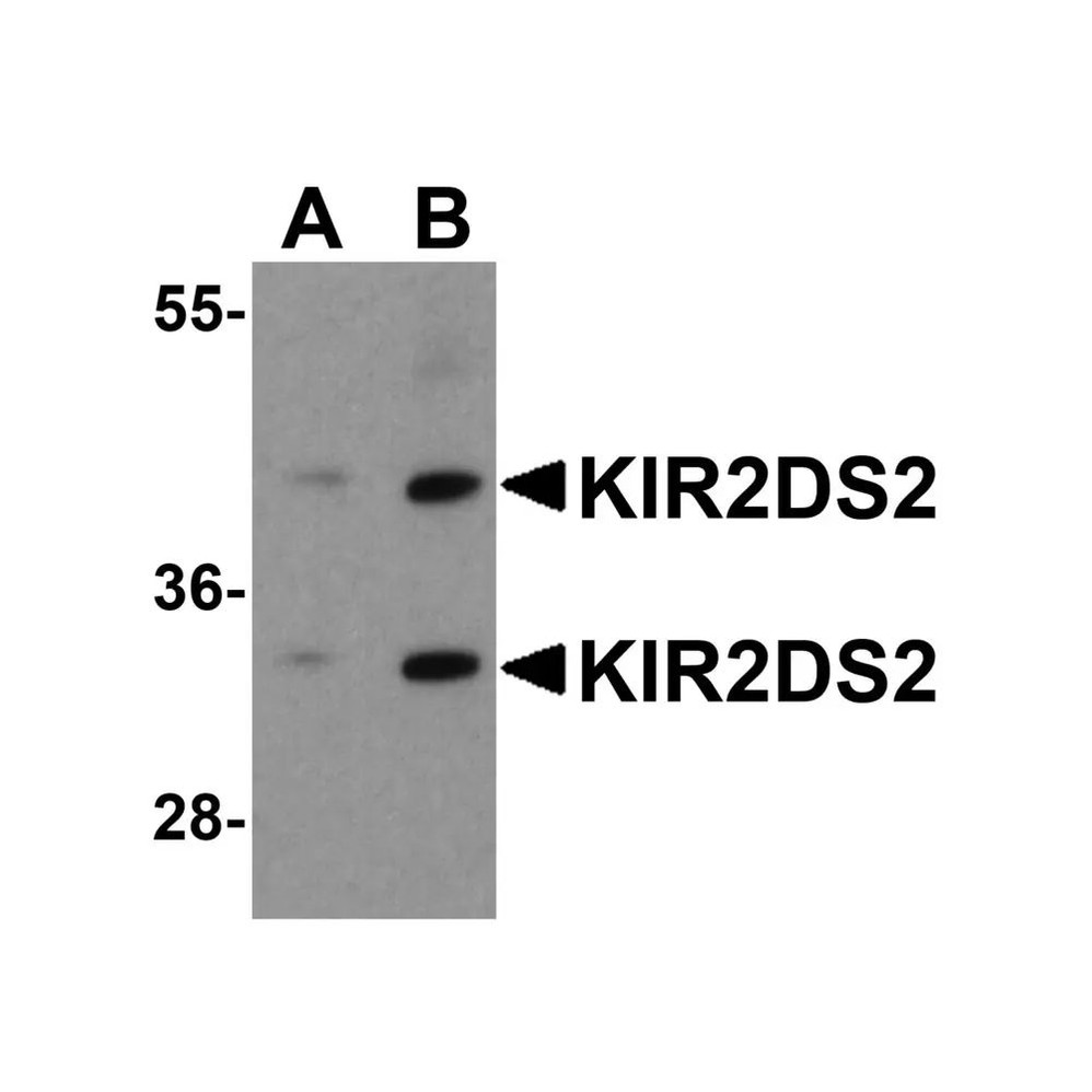 ProSci 8201 KIR2DS2 Antibody