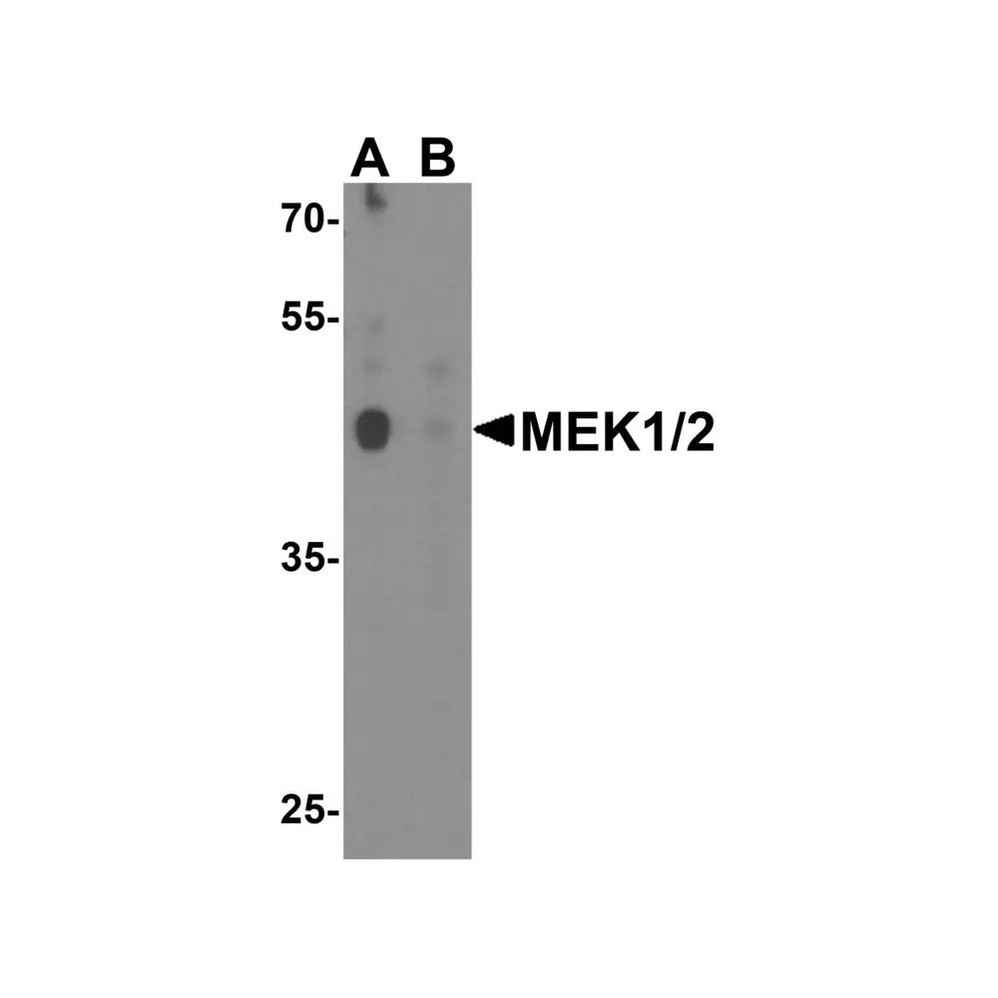 ProSci 8207 MEK1/2 Antibody