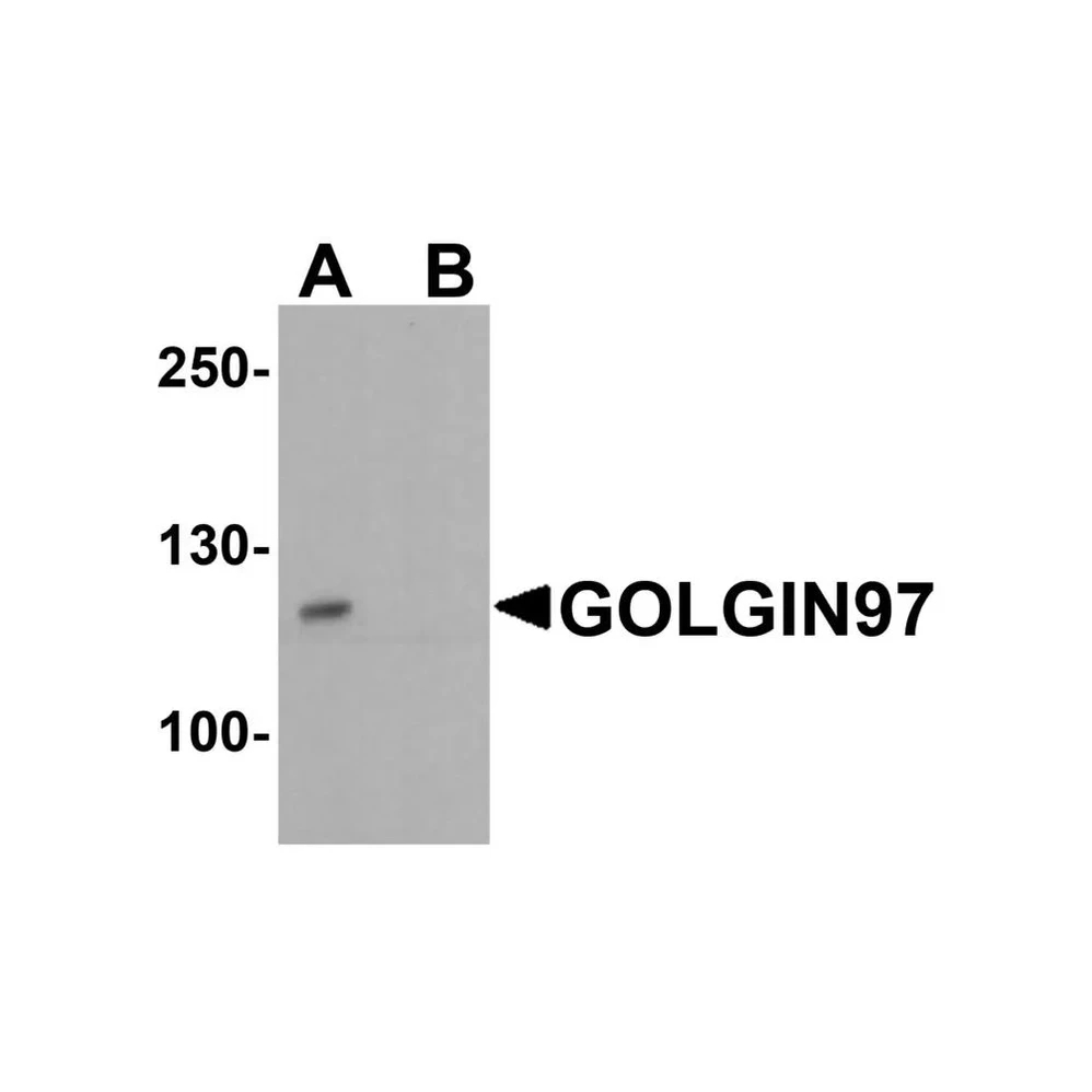 ProSci 8215 GOLGIN97 Antibody