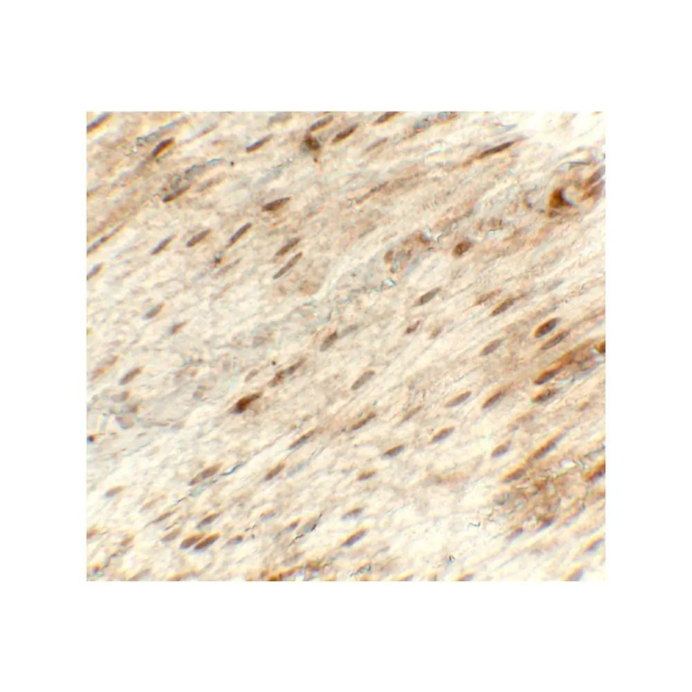 ProSci 8217 Hexokinase 1 Antibody