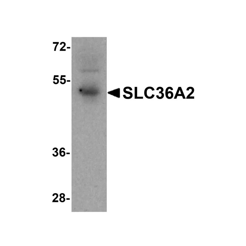 ProSci 8341 SLC36A2 Antibody