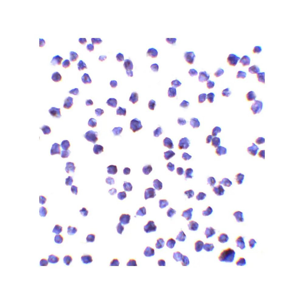 ProSci 8469 ALSFTD Antibody