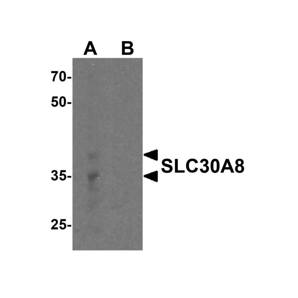 ProSci 8485 SLC30A8 Antibody