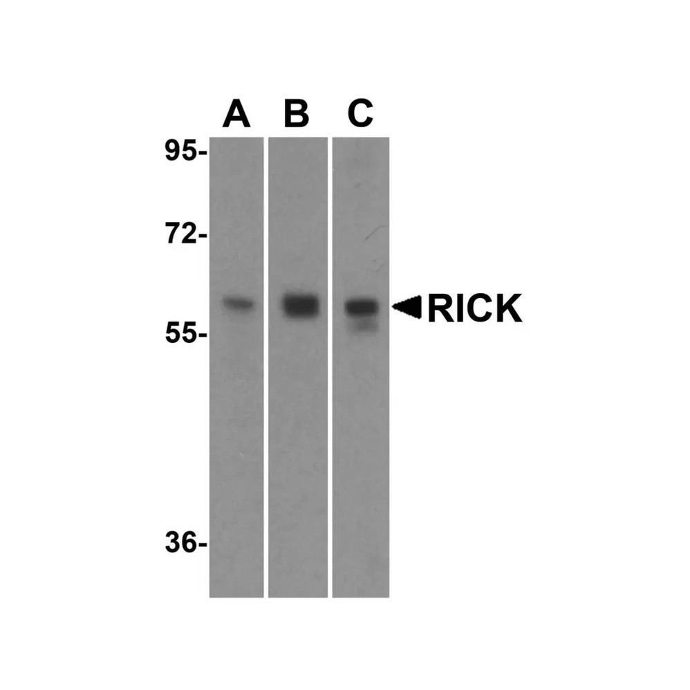 ProSci 2075 RICK Antibody