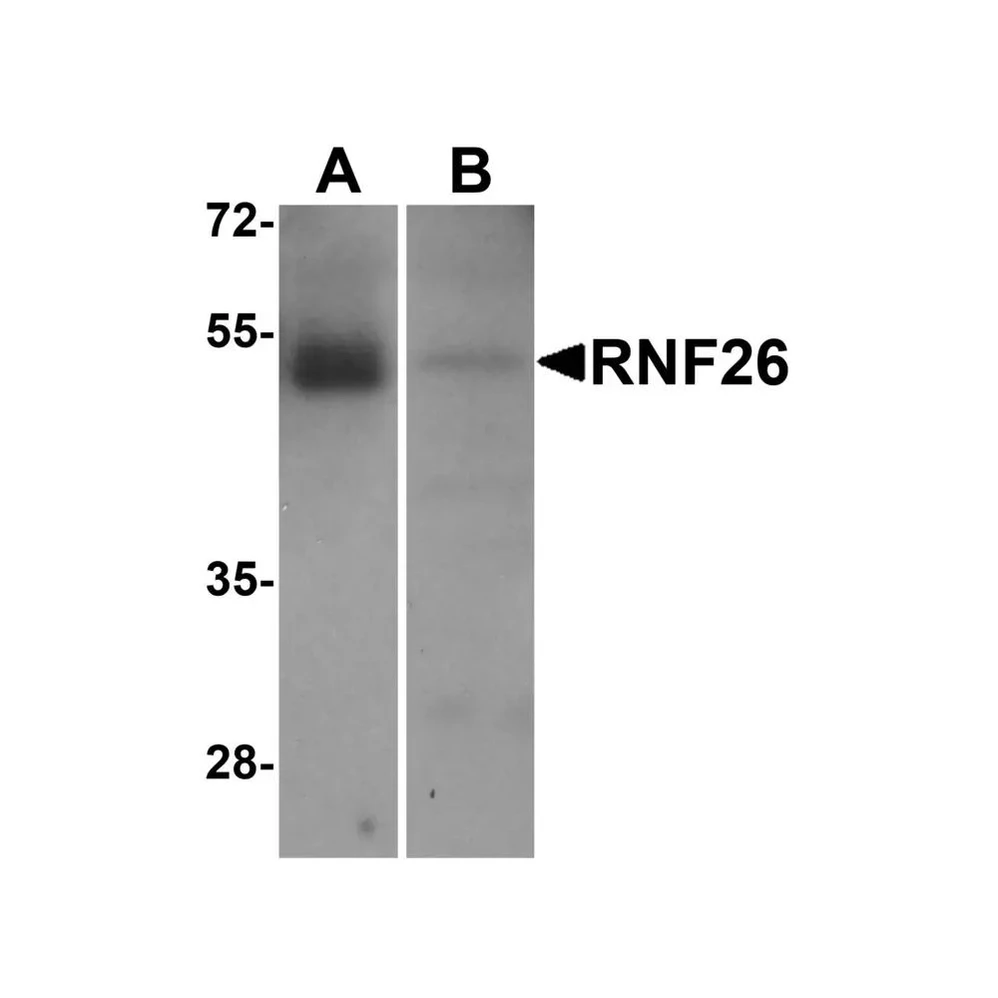ProSci 8549 RNF26 Antibody
