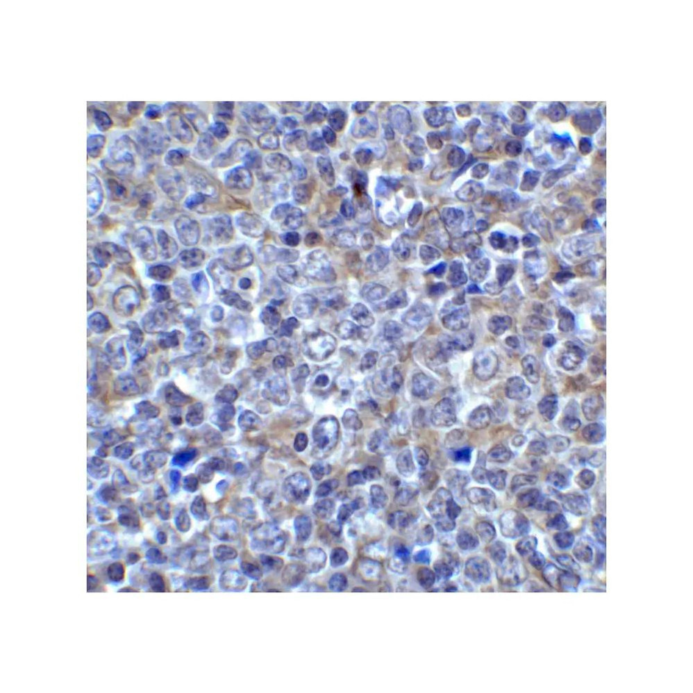 ProSci 8655 LAG3 Antibody