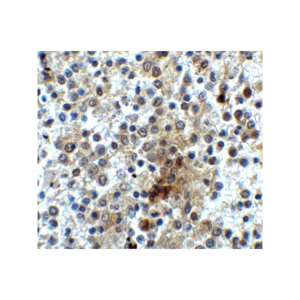 ProSci 8683 CD28 Antibody