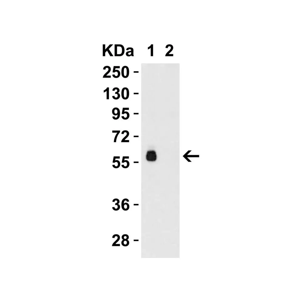 ProSci 8963 hRIP3 Antibody