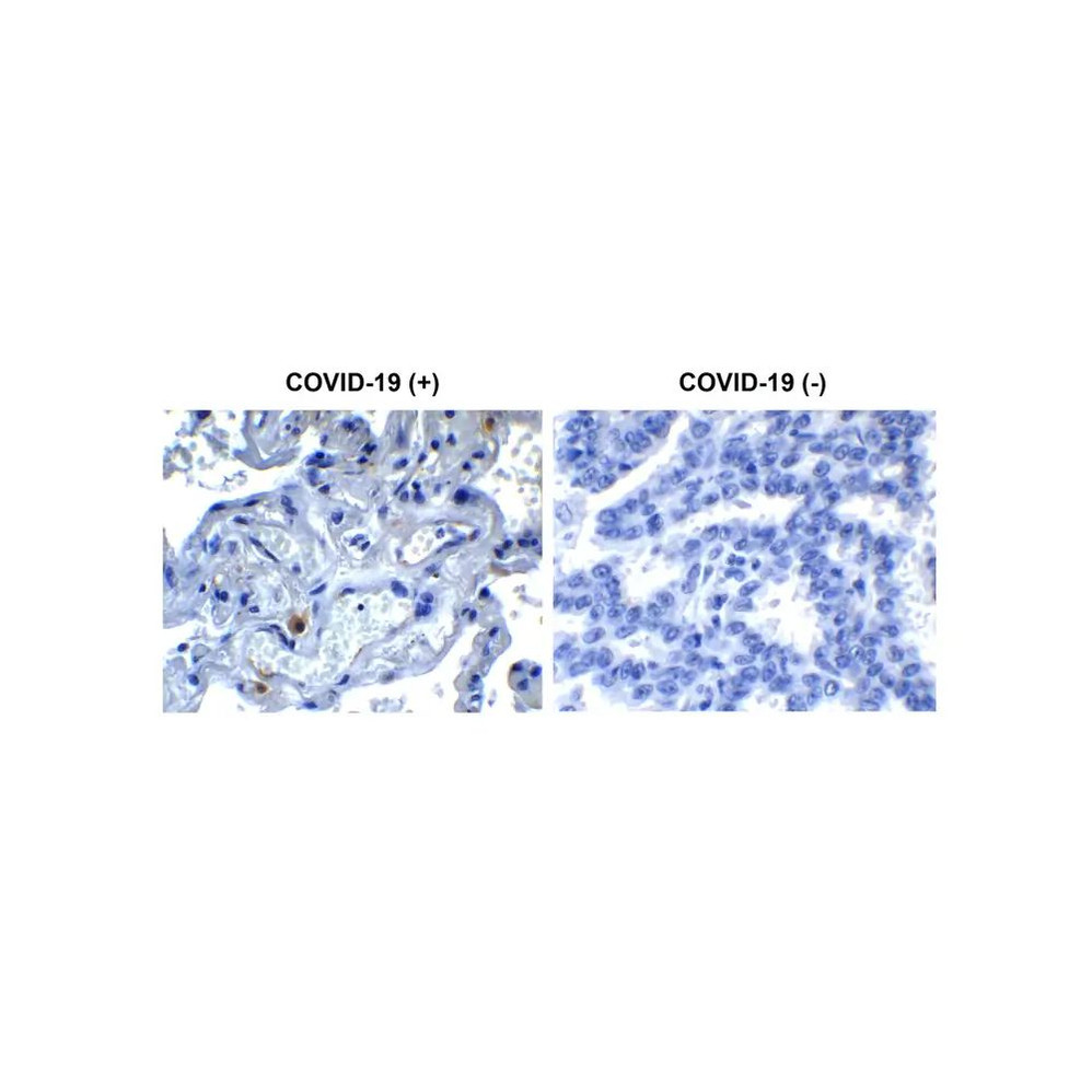ProSci 9161 SARS-CoV-2 (COVID-19) NSP9 Antibody
