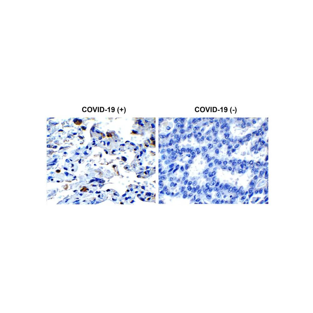 ProSci 9169 SARS-CoV-2 (COVID-19) Envelope Antibody