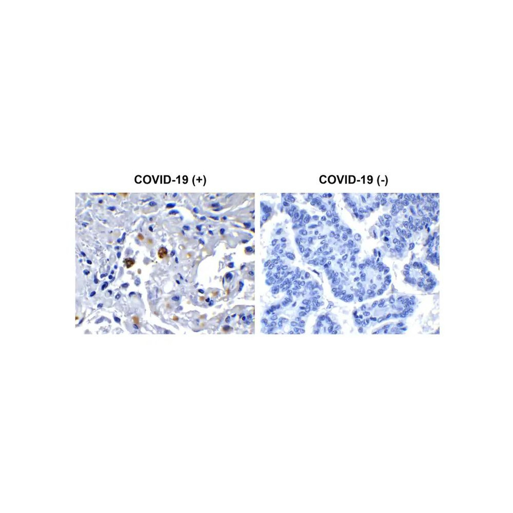 ProSci 9183 SARS-CoV-2 (COVID-19) NSP13 (Helicase) Antibody
