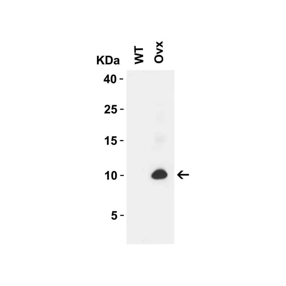 ProSci 9291 SARS-CoV-2 (COVID-19) ORF9c Antibody