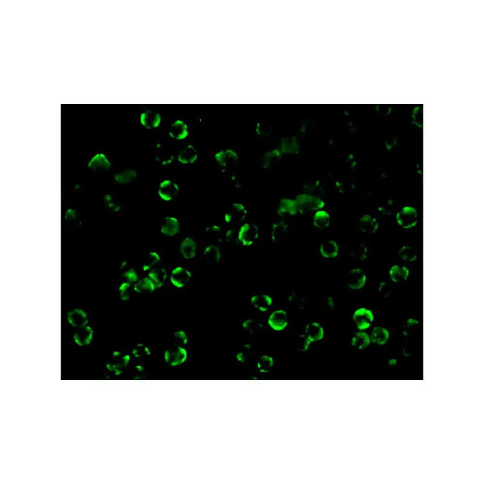 ProSci 2121 IKK beta Antibody