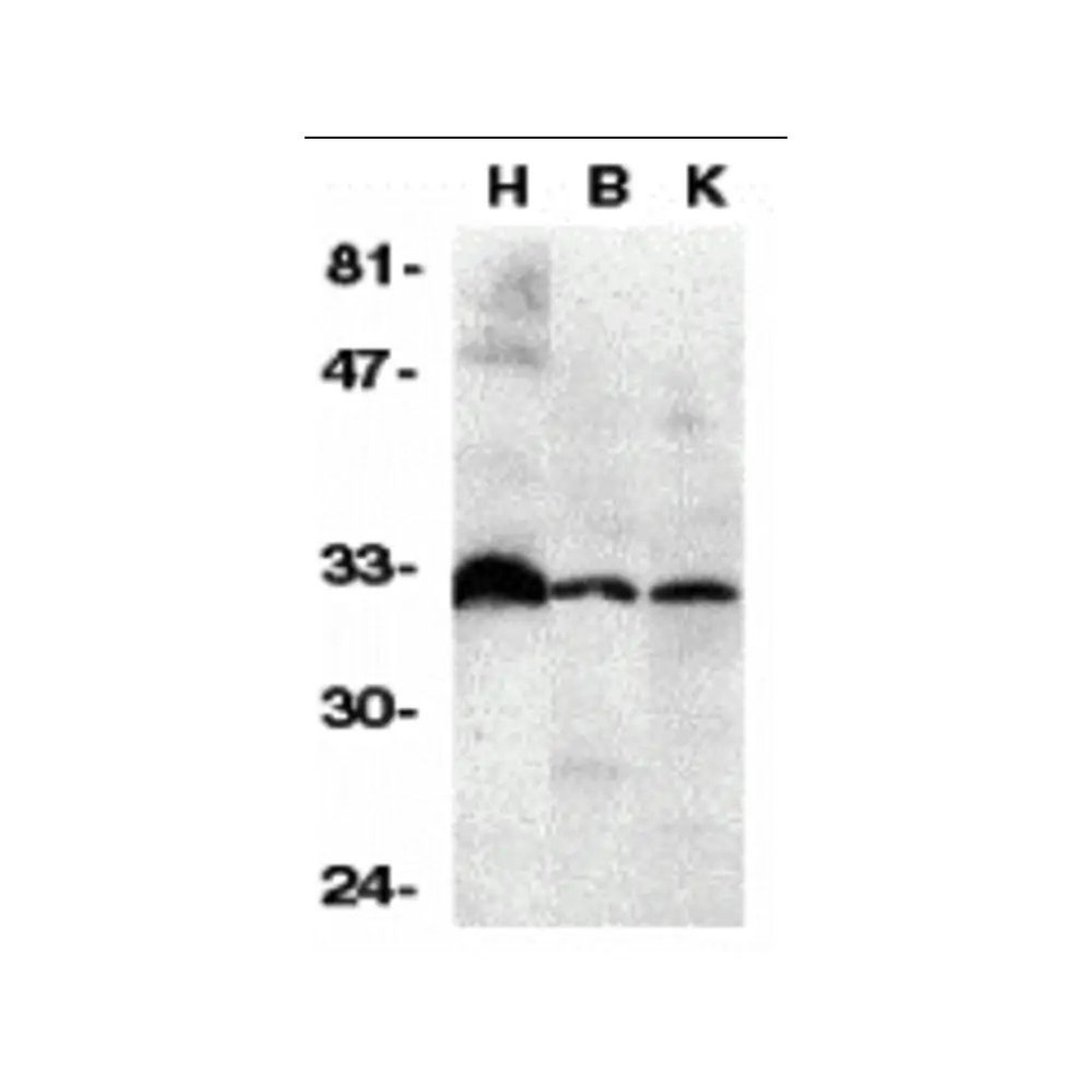 ProSci 2140 DcR3 Antibody