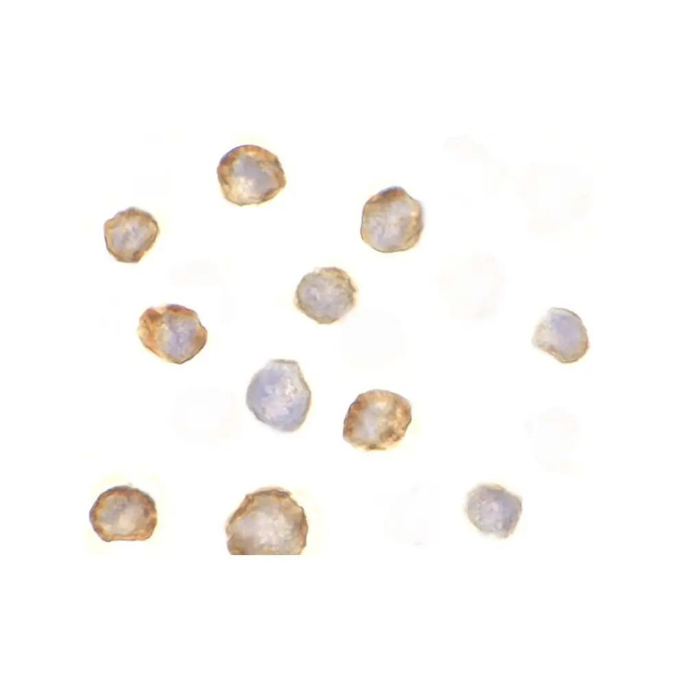 ProSci 2183 RICK Antibody