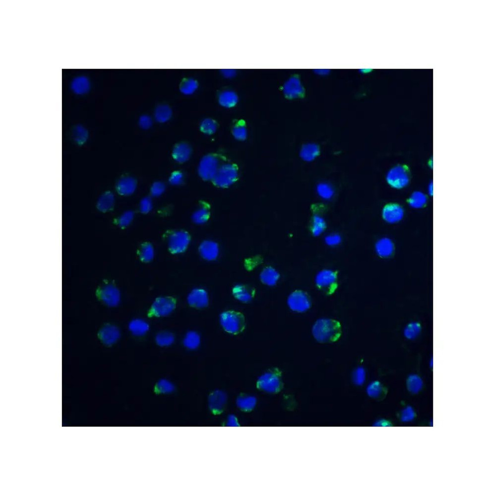 ProSci 2219 Acinus Antibody