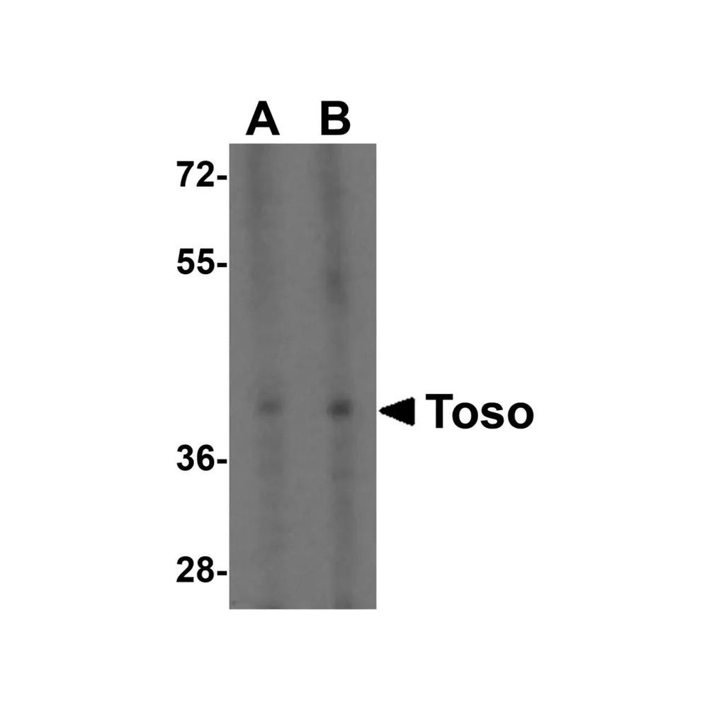 ProSci 2273 Toso Antibody