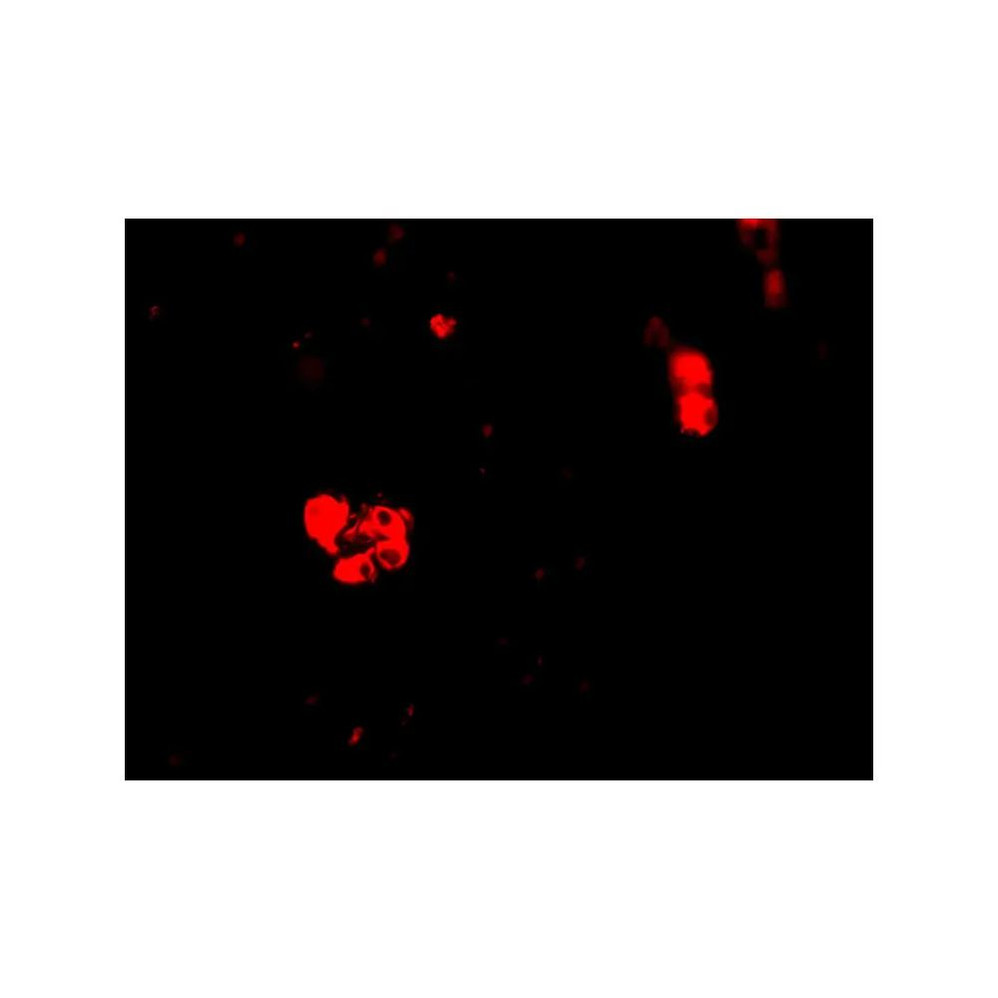 ProSci 2319 CIDE-B Antibody