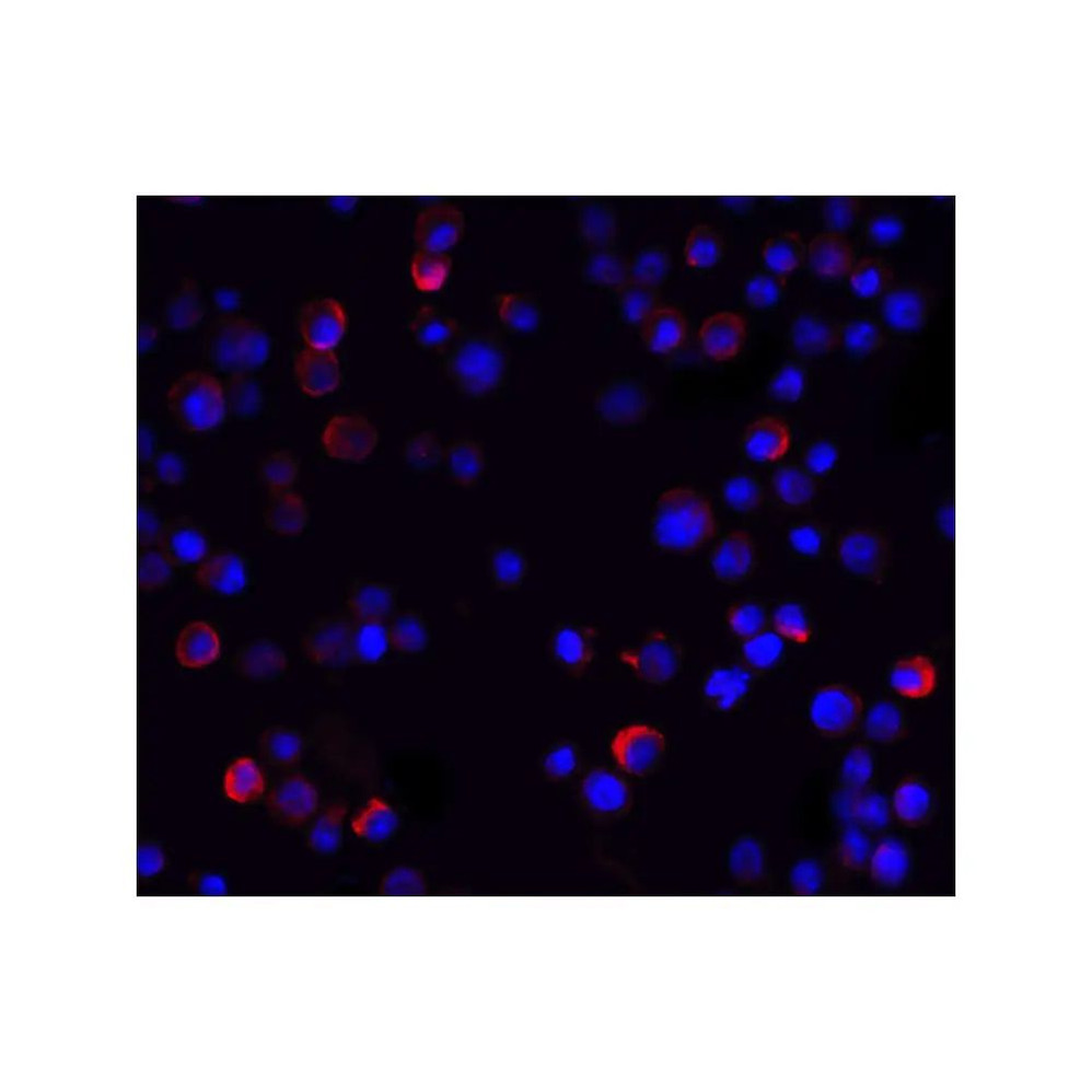ProSci 2335 IKK gamma Antibody