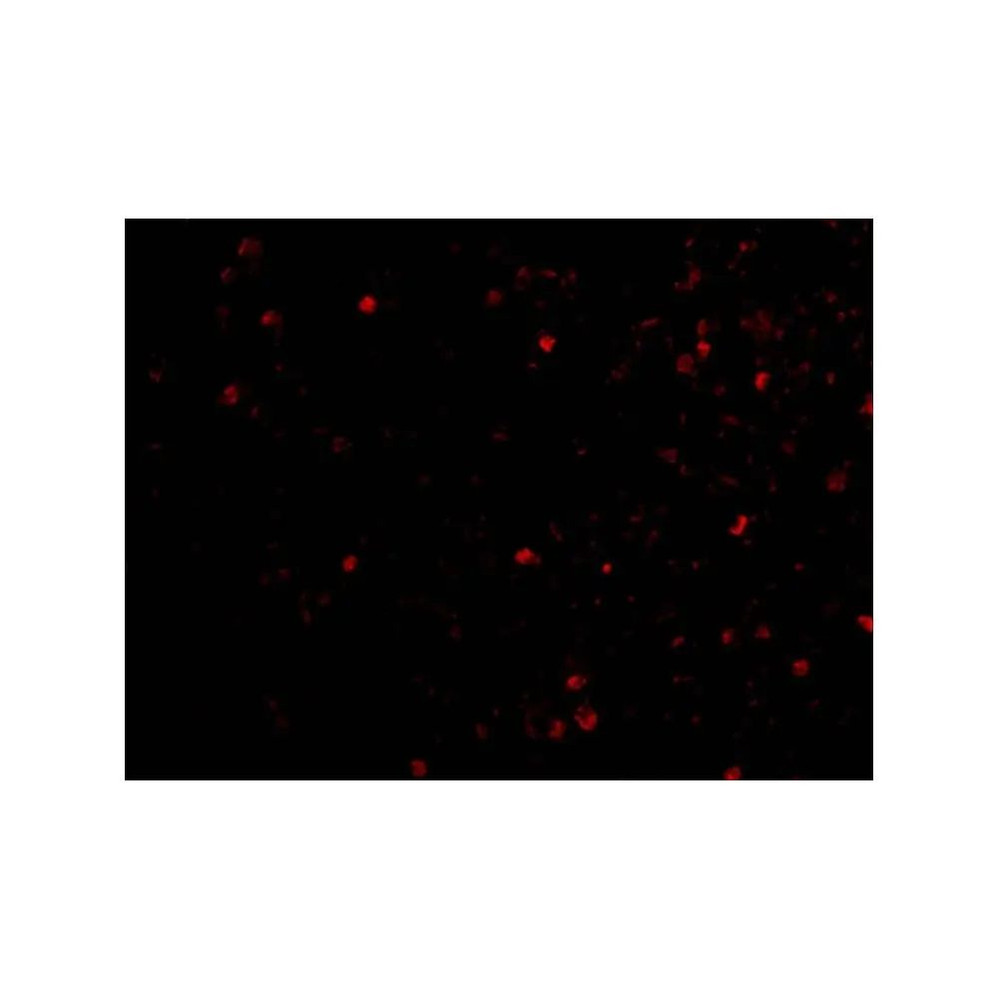 ProSci 2337 IKAP Antibody