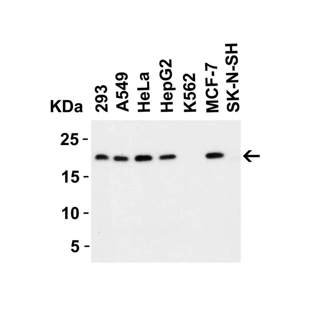 ProSci 2451 PERP Antibody