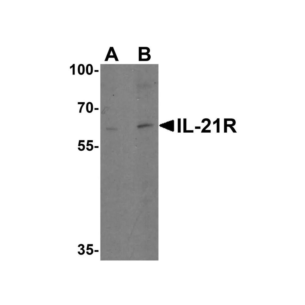 ProSci 2469 IL-21 Receptor Antibody