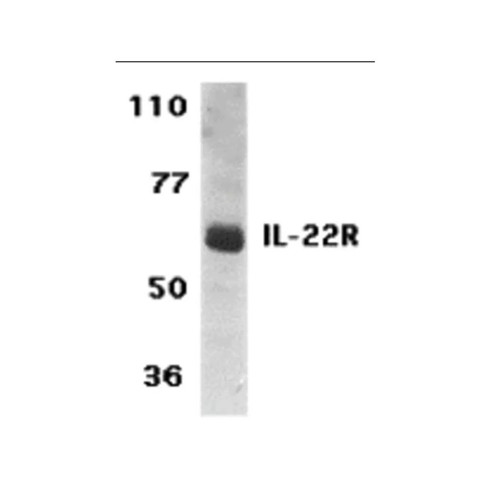 ProSci 2489 IL-22 Receptor Antibody